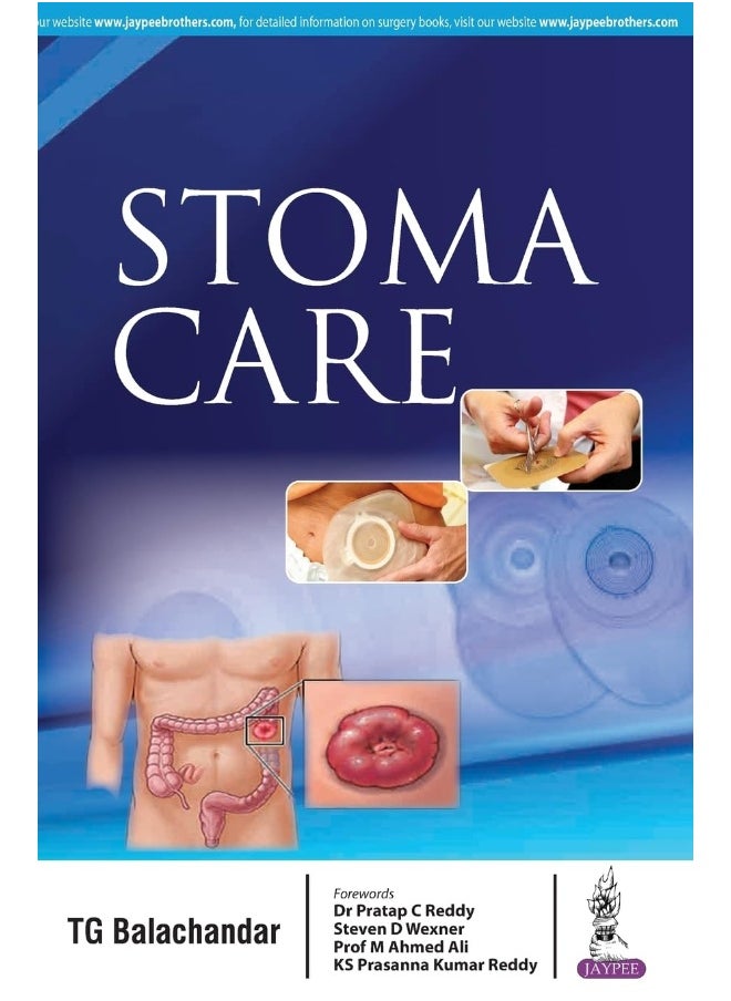 Stoma Care 