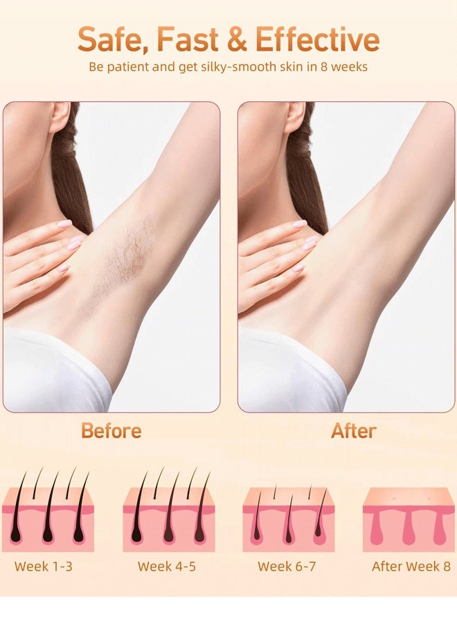 XiuWoo 3 in 1 Ipl Machine Ice Painless Hair Removal Skin Rejuvenation Home Use Permanent Professional Ipl Laser Hair Removal - Image 5