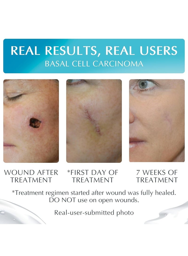 نيو جل جل سيليكون متطور لعلاج الندب وأثار الجرح 15جرام - Image 2