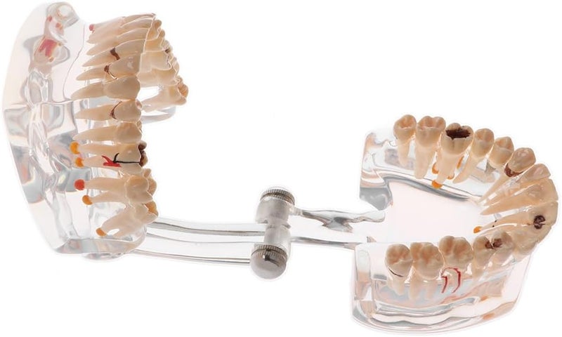 klarakoMouth Pathology Human Anatomy Model 2x Magnification Teaching Tool - Image 2