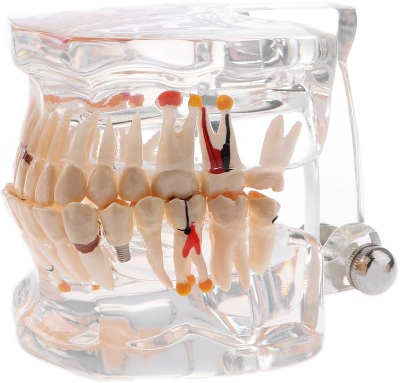 klarakoMouth Pathology Human Anatomy Model 2x Magnification Teaching Tool - Image 3