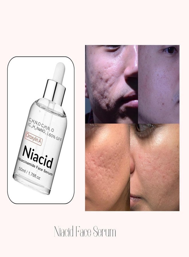 VIVAGLO Niacid Niacinamide Face Serum 5% for Oily Dry Combination Skin Brightening Open Pores Tightening Pitted Scars & Dark Acne Marks Oil Control 50ml - Image 2