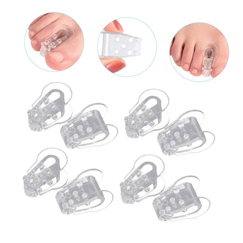 GALPADA 40pcs Separators for Bunion Foot Spacers for Overlapping Comfortable Gel Spreader for Men and Women Lightweight Foot Care Tool - Image 2