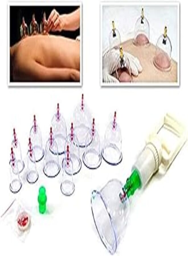 Curious Cat Magnet Therapy Cupping Pull Out Vacuum Apparatus