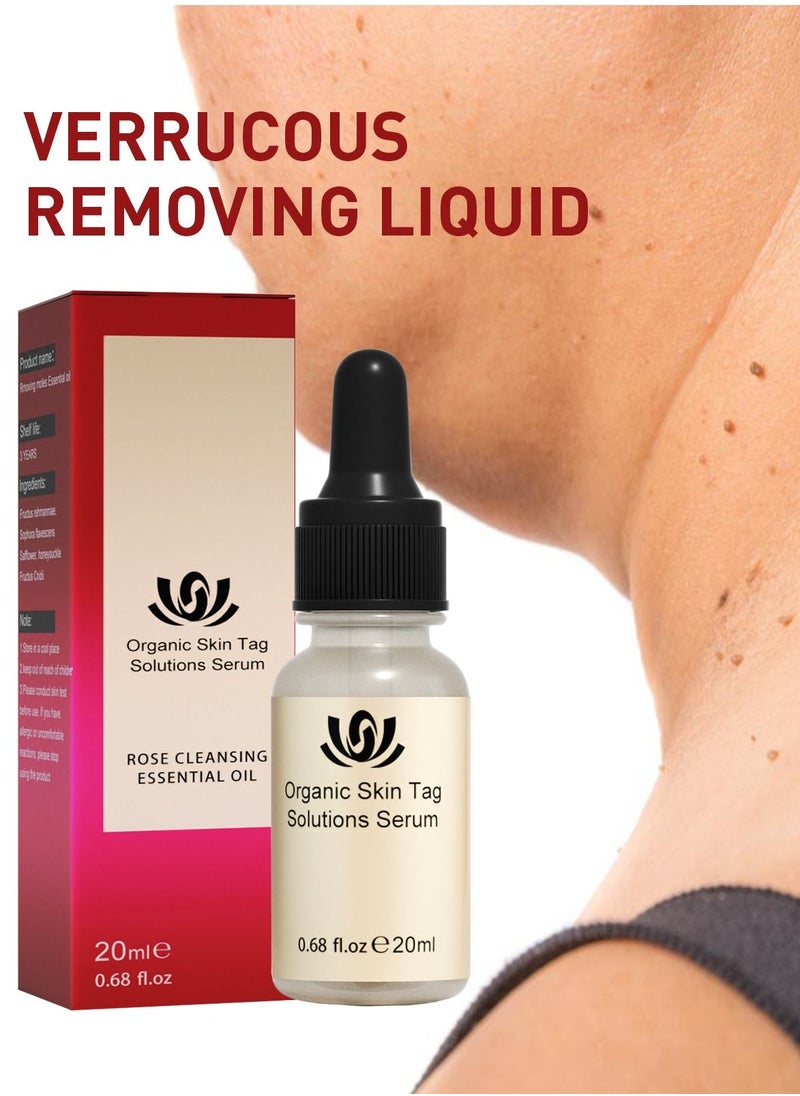 Arabest Alive Skin Mole Removal Oil 20ml  - Image 5