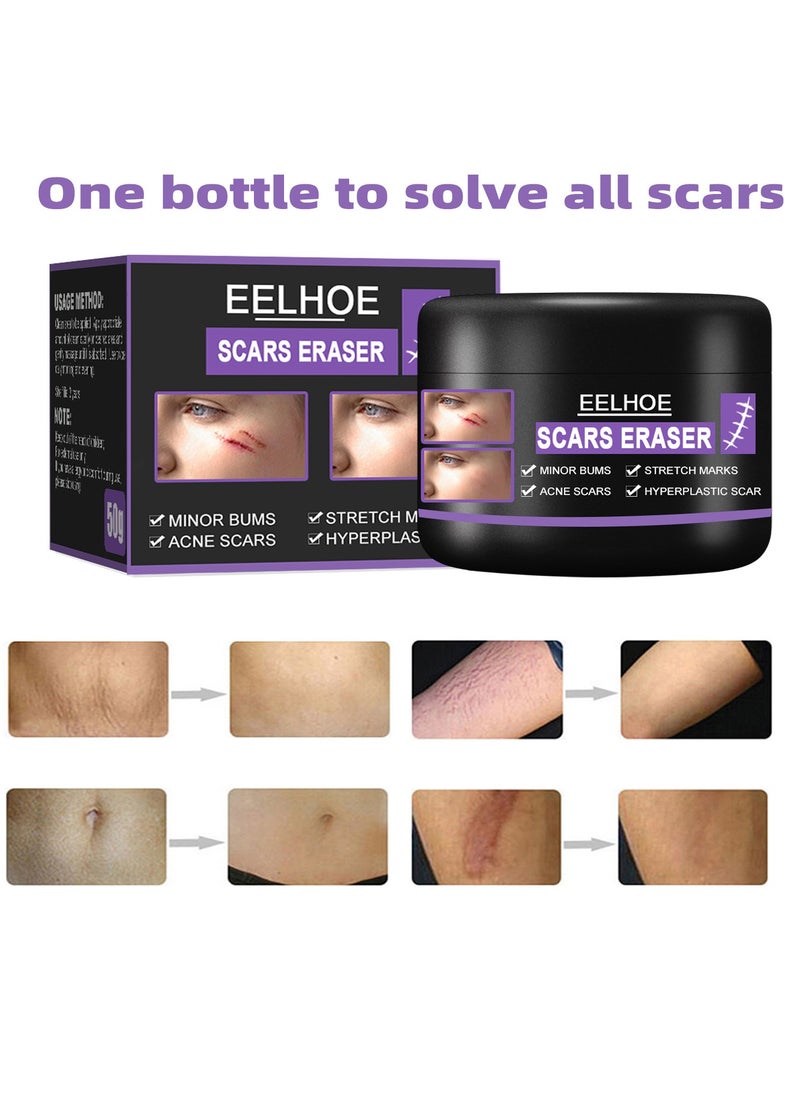 EELHOE - Scar Removal Cream Quick Effect for New and Old Pregnancy Scald and Operation Scar ，Scar Erase ，Acne Scar Treatment，Deep Acne Scar Removal，Burns Keloids Hypertrophic，Removing Acne Marks Scar Repair Cream - Image 1