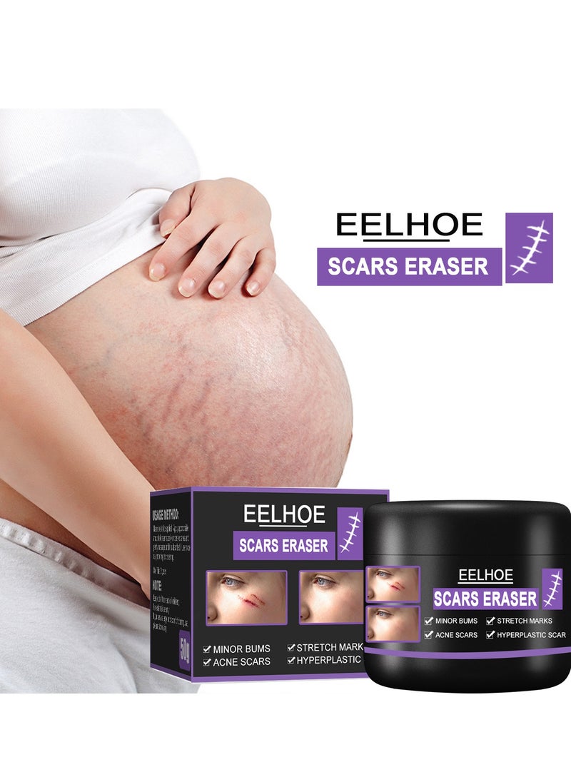 EELHOE - Scar Removal Cream Quick Effect for New and Old Pregnancy Scald and Operation Scar ，Scar Erase ，Acne Scar Treatment，Deep Acne Scar Removal，Burns Keloids Hypertrophic，Removing Acne Marks Scar Repair Cream - Image 1