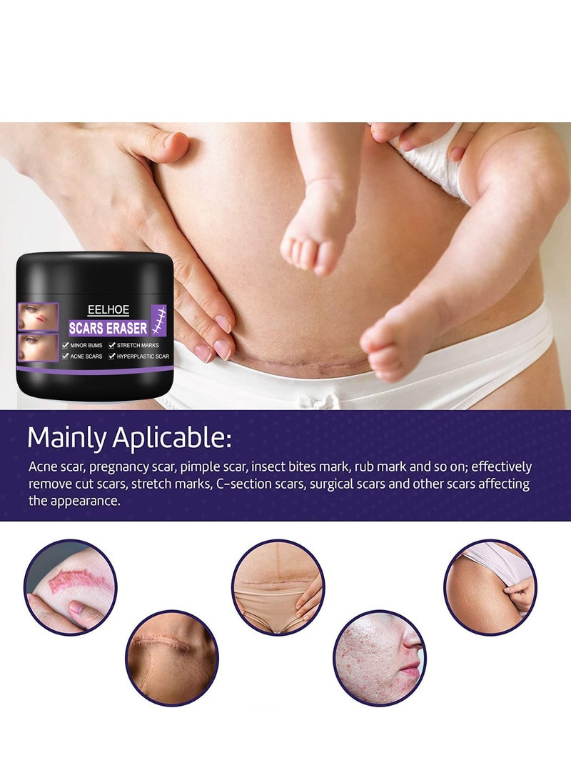 EELHOE - Scar Removal Cream Quick Effect for New and Old Pregnancy Scald and Operation Scar ，Scar Erase ，Acne Scar Treatment，Deep Acne Scar Removal，Burns Keloids Hypertrophic，Removing Acne Marks Scar Repair Cream - Image 1