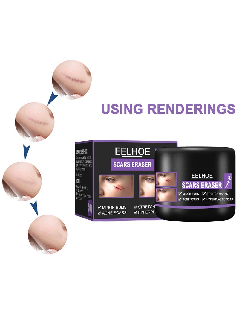 EELHOE - Scar Removal Cream Quick Effect for New and Old Pregnancy Scald and Operation Scar ，Scar Erase ，Acne Scar Treatment，Deep Acne Scar Removal，Burns Keloids Hypertrophic，Removing Acne Marks Scar Repair Cream - Image 1