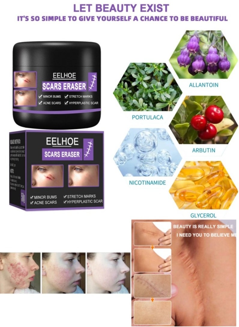 EELHOE - Scar Removal Cream Quick Effect for New and Old Pregnancy Scald and Operation Scar ，Scar Erase ，Acne Scar Treatment，Deep Acne Scar Removal，Burns Keloids Hypertrophic，Removing Acne Marks Scar Repair Cream - Image 1