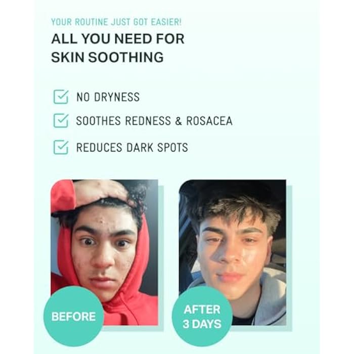 BRING GREEN ZINC TECA Serum with Niacinamide | Soothing Face Serum for Sensitive Skin, Pore Minimizing & Hydrating | Korean Skincare for Breakouts & Uneven Texture - Image 5