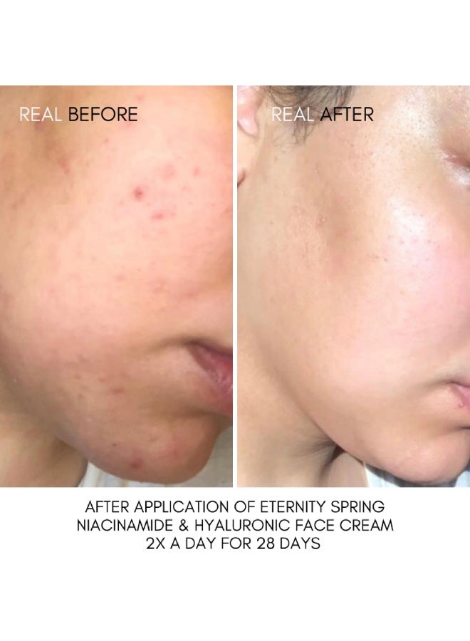 NUT BOTANICALS Eternity Spring Niacinamide and Hyaluronic Face Cream 120ml - Image 3