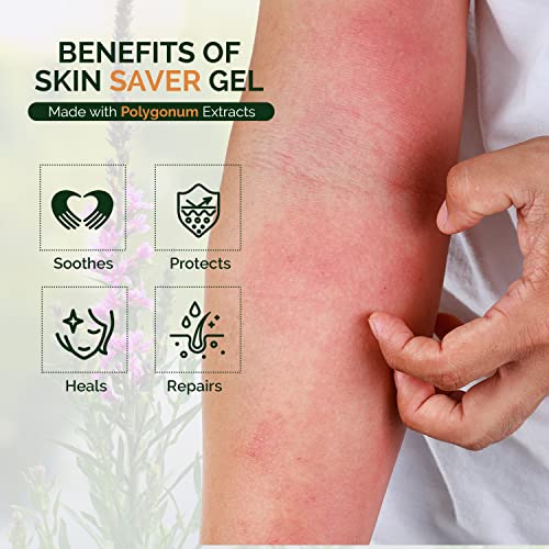 Moraz Skin Saver Herbal Healing Scar Gel for Skin Repair and Wound Care – Multi-Purpose First Aid Moisturizer for Dry Skin, Minor Cuts and Scrapes, Bug Bite Itch Relief, Sunburn & Rashes (1.7 Oz) - Image 3