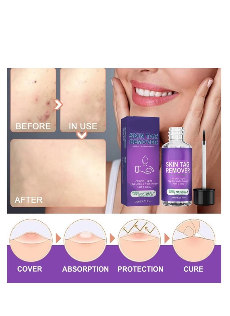 EELHOE Skin Tag Remover, Natural Wart and Mole Removal with Safe Ingredients â Effective Frozen Formula for Skin Renewal without Irritation, Easy to Use for Face and Body (30 ml) - Image 2