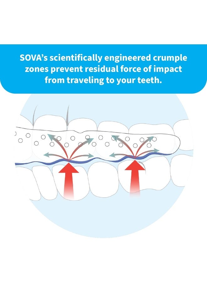 SOVA Aero Night Guard - 1.6mm Thin - Custom-Molded Fit - Protects Against Nighttime Teeth Grinding & Clenching - FSA/HSA Eligible - Odor & Taste Free - Remoldable Up to 20 Times - Non Toxic - Image 5