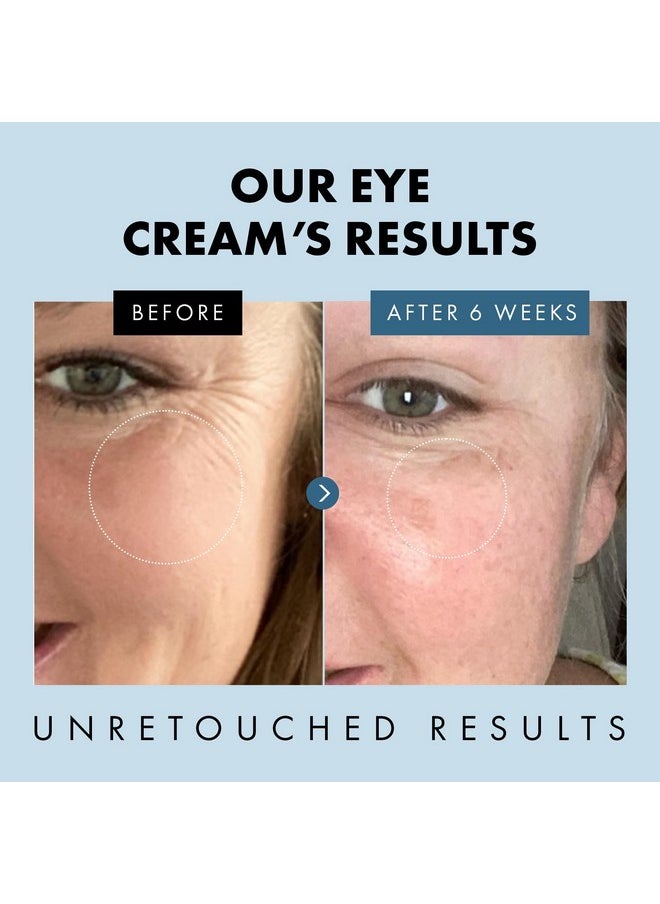 Eclat Skincare Under Eye Cream for Dark Circles and Puffiness - Eye Repair Cream Dark Circles Under Eye Treatment - Eye Cream Anti Aging Under Eye Serum Moisturizer Puffy Eyes Treatment Dark Circle  - Image 4
