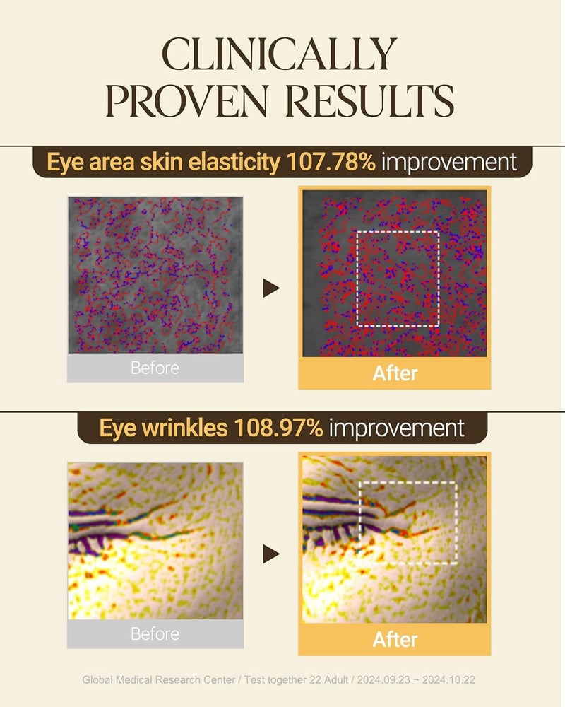 About Me Glycine Soybean Core Eye Cream Korean MultiZone Eye Treatment for All Skin Types Daily Firming Care with Concentrated Soy Protein 13 Peptides Korean Skin Care 051oz 15ml - Image 3