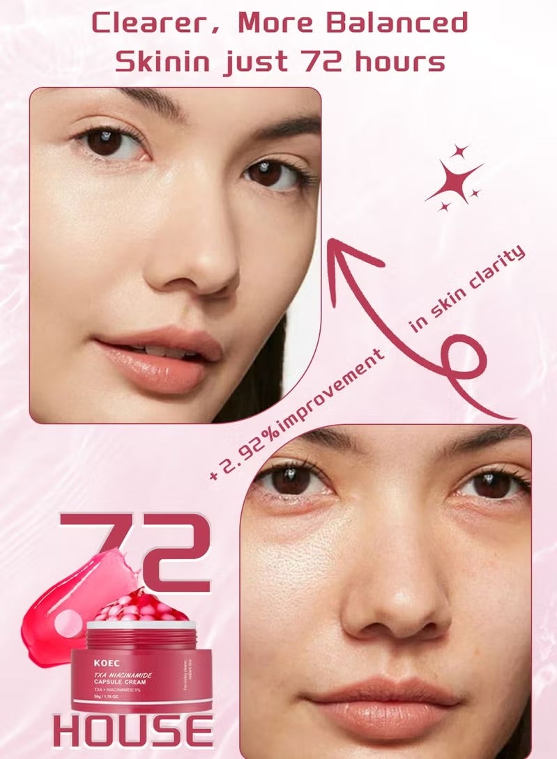 ك أو إي سي TXA + Niacinamide 5٪ كريم كبسولة ، مرطب الإشعاع المزدوج ، مثالي للاستخدام بعد العناية بالبقعة ، 50g - Image 4