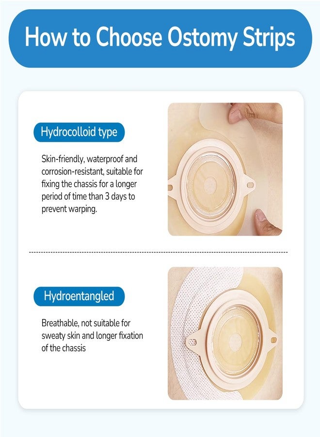 Heagimed 20PCS Ostomy Barrier Strips, Skin-Friendly Hydrocolloid Skin Barrier Strips, Elastic Barrier Strips for Ostomy Bag Ostomy Colostomy Ileostomy Supplies - Image 3