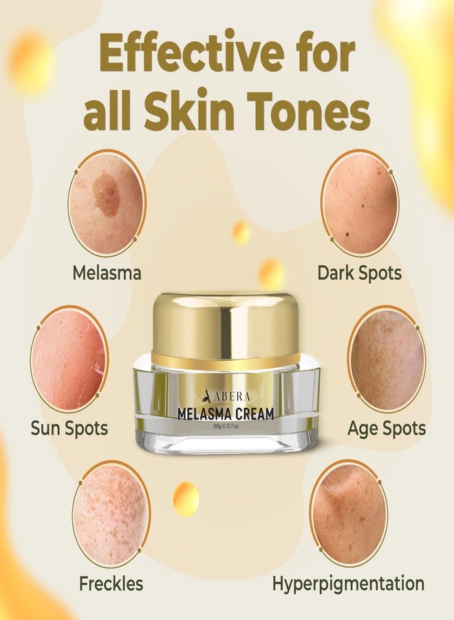 ABERA Melasma Cream (Premium Version) - Dark Spot Corrector, Melasma, Freckle, Sun Spot, Age Spot Remover Advanced Formula for Women and Men (0.7 Oz Per Item) - Image 5