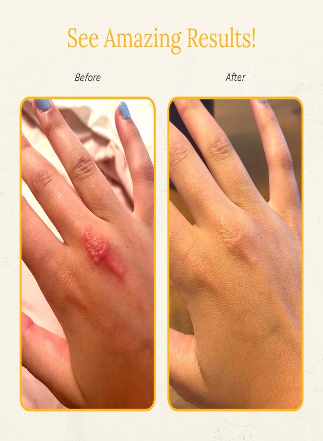 Rejuvaskin كريم استعادة البشرة من ريجوفا مع الألوة فيرا، كريم مرطب مهدئ للبشرة الجافة والحساسة والمتهيجة، 100 مل - Image 5