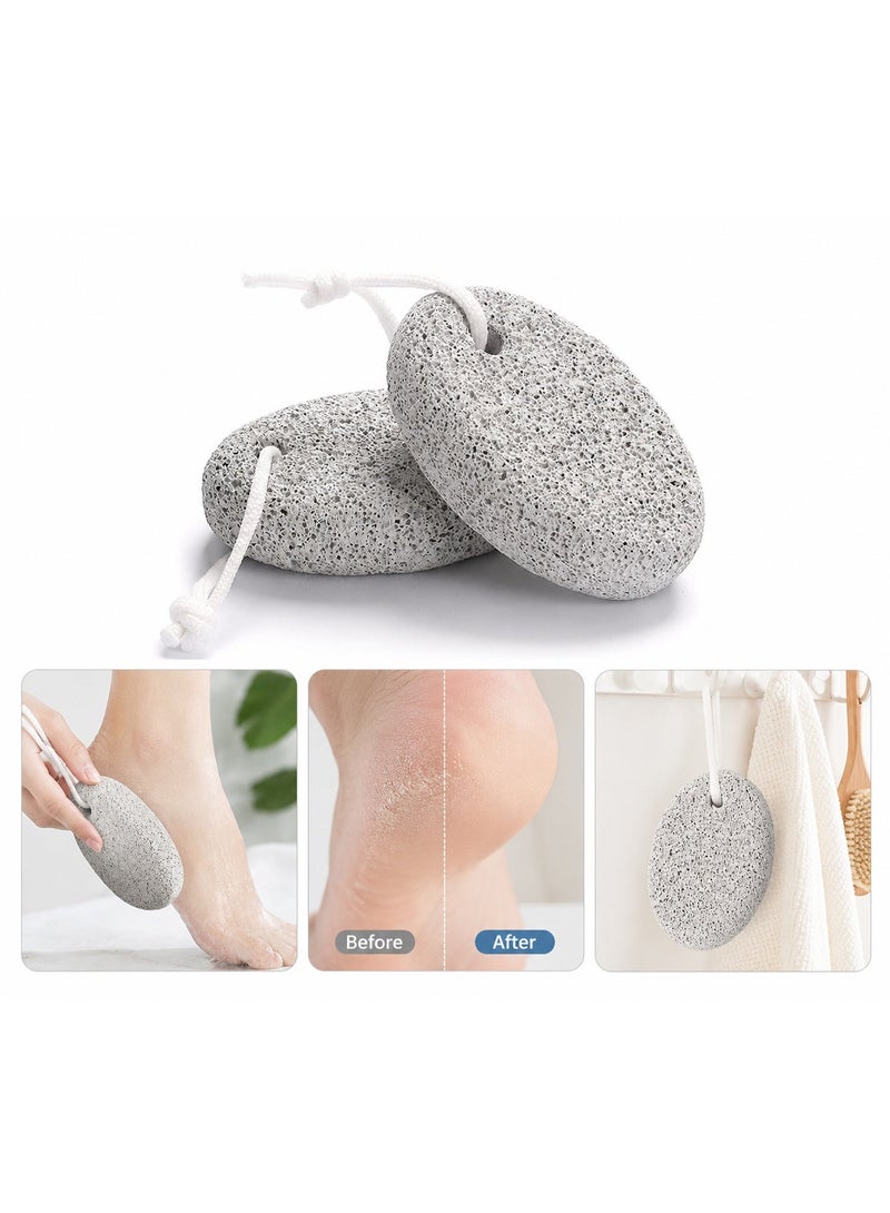 ORiTi Natural Pumice Stone for Feet, 2-Pack Lava Pedicure Tools Hard Skin Callus Remover for Feet and Hands - Natural Foot File Exfoliation to Remove Dead Skin - Image 1
