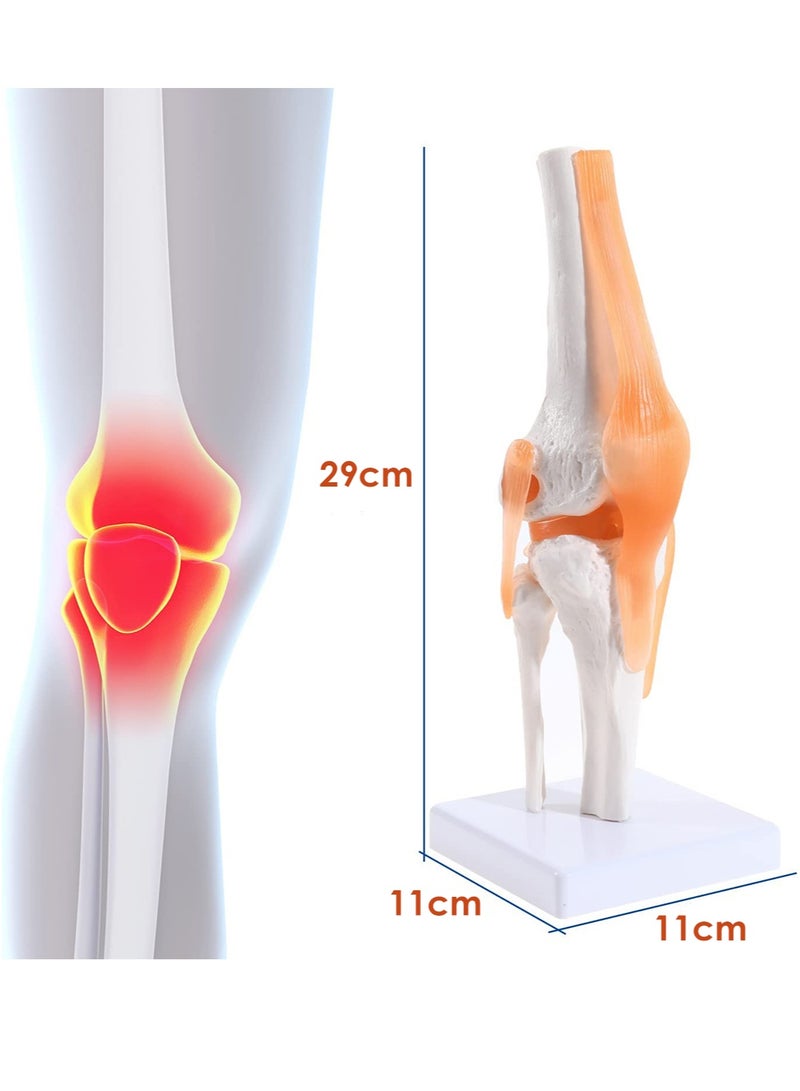Human Knee Joint Model, 1:1 Scientific Life Size Anatomy Model with Ligaments, Anatomical Teaching Tool for Patient Education and Medical Study - Image 3
