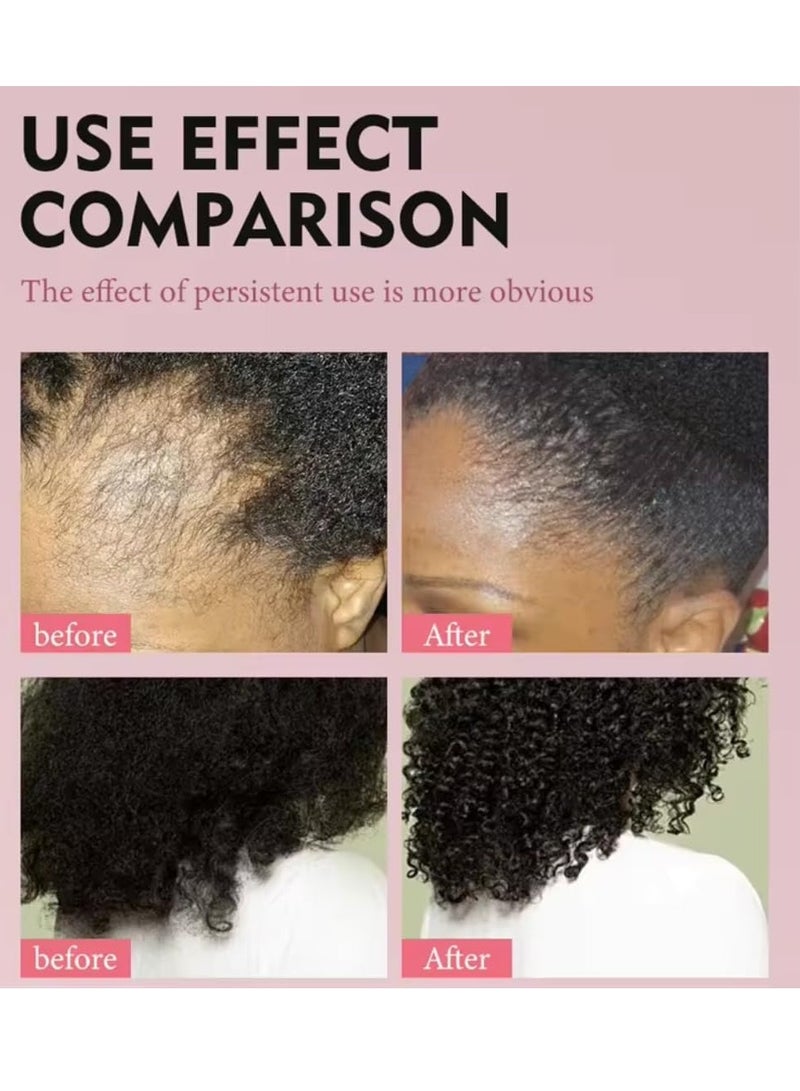 Sevich Karkar Chebe Hair Growth Oil 100% Pure and Natural Soothes Repairs Scalp for Hair Growth with Karkar and Chebe Rosemary and Castor Seed Oil Moisturize Hydrate Prevent Hair Breakage Chebe oil 40ml - Image 2