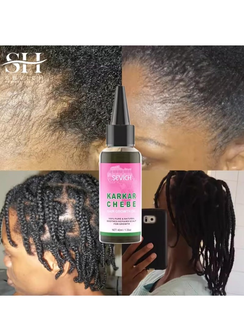 Sevich Karkar Chebe Hair Growth Oil 100% Pure and Natural Soothes Repairs Scalp for Hair Growth with Karkar and Chebe Rosemary and Castor Seed Oil Moisturize Hydrate Prevent Hair Breakage Chebe oil 40ml - Image 4