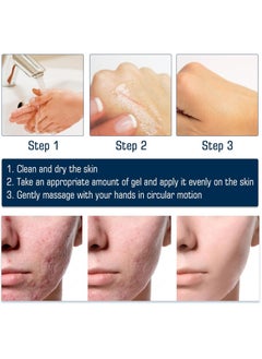West&Month Silicone Scar Removal Gel, Hight Quality Scar Removal Gel, Acne Scar Treatment, Deep Acne Scar Removal, Burns Keloids Hypertrophic, Repair Damaged Skin, Removing Acne Marks Scar Repair Cream ﻿  - Image 2