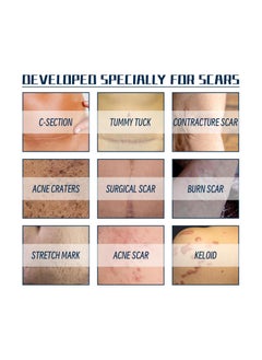 West&Month Silicone Scar Removal Gel, Hight Quality Scar Removal Gel, Acne Scar Treatment, Deep Acne Scar Removal, Burns Keloids Hypertrophic, Repair Damaged Skin, Removing Acne Marks Scar Repair Cream ﻿  - Image 3