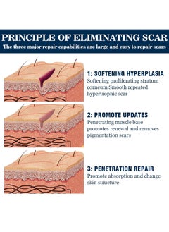 West&Month Silicone Scar Removal Gel, Hight Quality Scar Removal Gel, Acne Scar Treatment, Deep Acne Scar Removal, Burns Keloids Hypertrophic, Repair Damaged Skin, Removing Acne Marks Scar Repair Cream ﻿  - Image 4