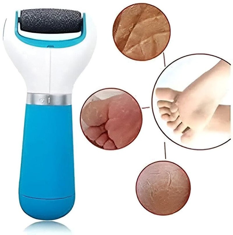 Skin Exfoliator - Upgrade your foot care regimen with this skin scrubber, designed to remove dead skin, promote healthy feet and make feet smooth without irritation, perfect for personal use at home. - Image 3