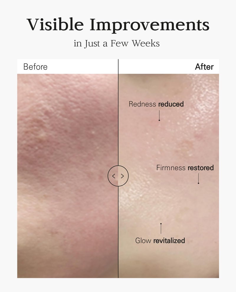 BD BLANC DUBU Nuborn Cell Placenta Stem Cell Intensive Repair Cream | Dragon Blood Cream with Placental Extract | Collagen Korean Skin Care for Glass Skin (50ml) - Image 4