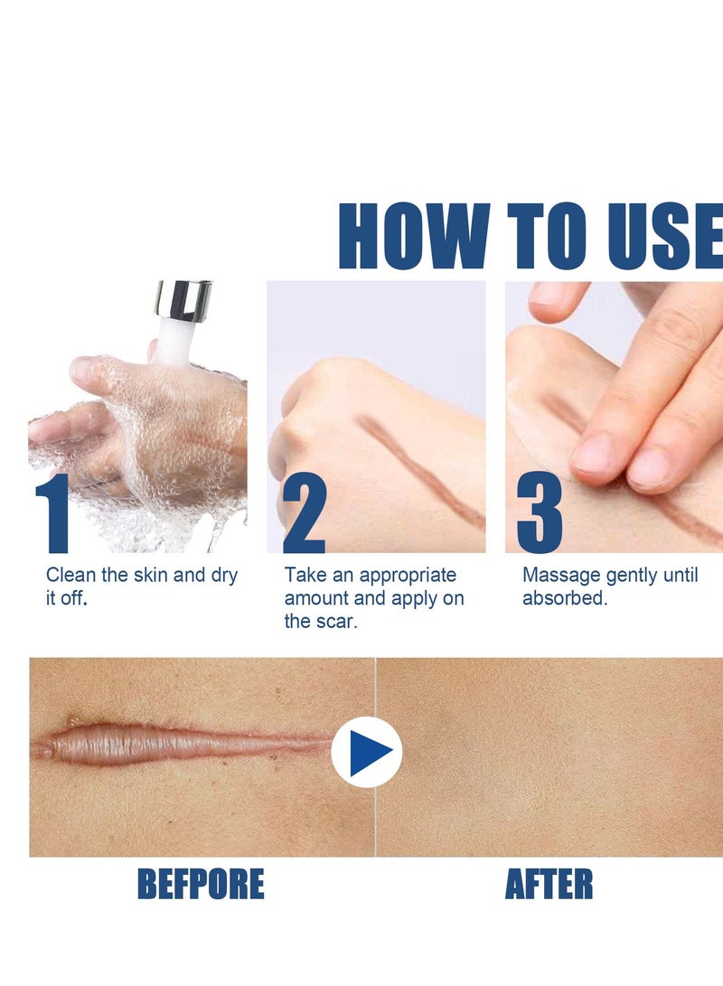 EELHOE New Gel Advanced Silicone Gel Of Scar Cream - Image 3