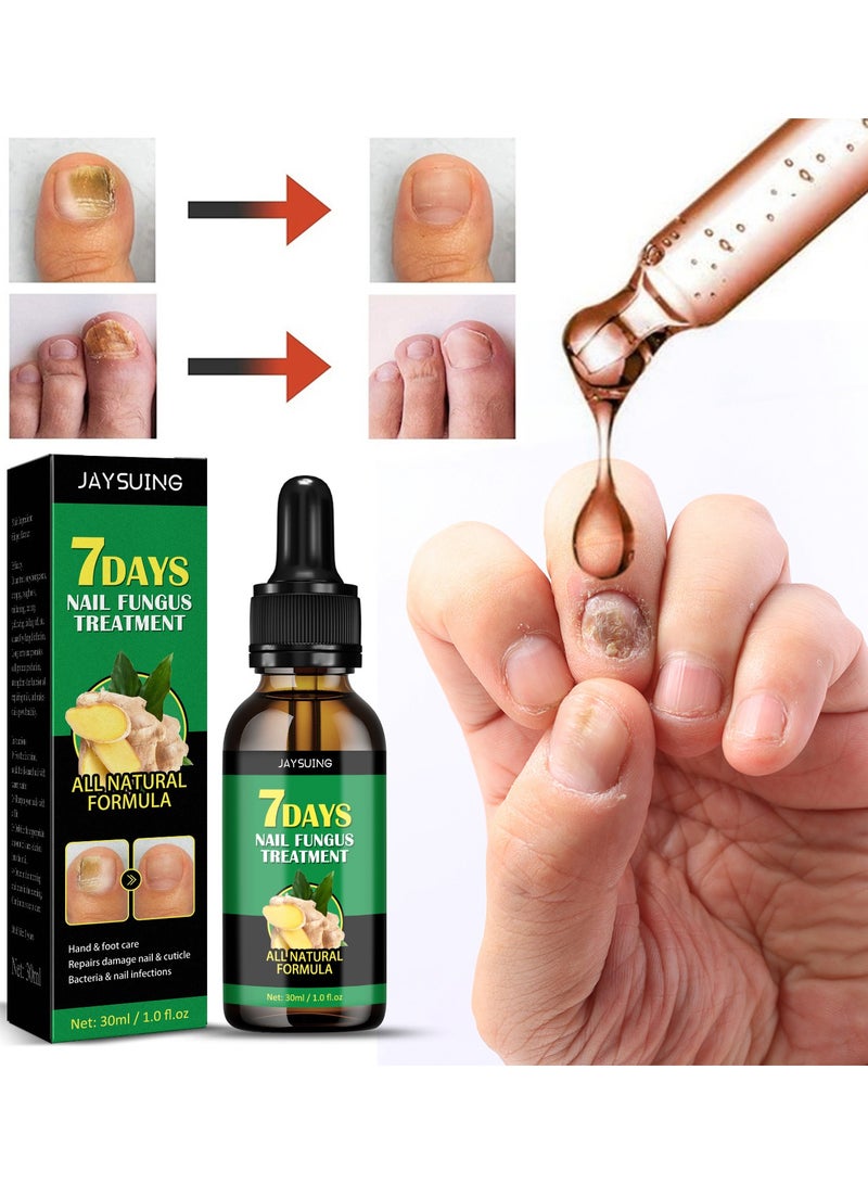 Jaysuing Nail Fungus Treatment for Nail Care Onychomycosis Repair and Moisturizing - Image 1
