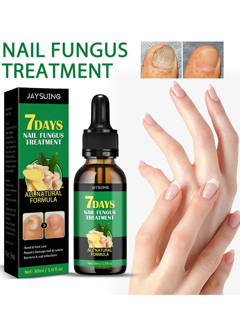 Jaysuing Nail Fungus Treatment for Nail Care Onychomycosis Repair and Moisturizing - Image 2