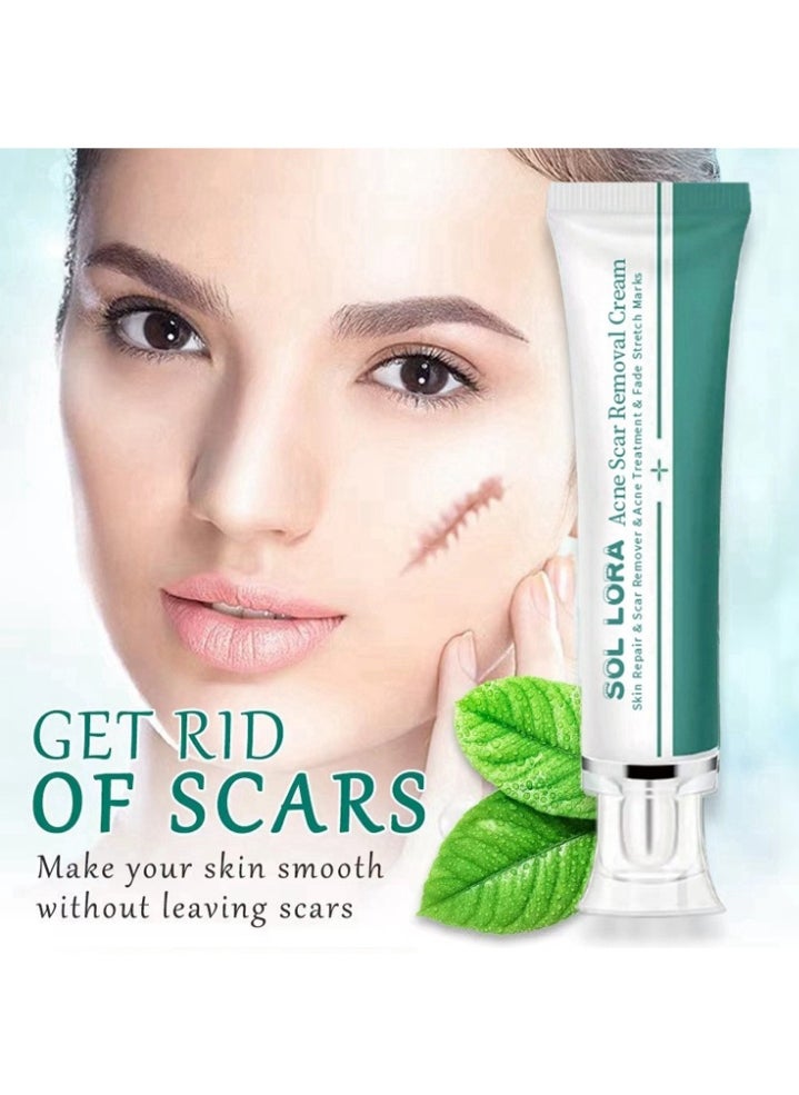 SOL LORA Acne Scar Removal Cream，Skin Repair Scar Remover & Acne Treatment & Fade Stretch Marks, Scar Erase ,Scar Removal Gel,Acne Scar Treatment,Deep Acne Scar Removal,Burns Keloids Hypertrophic,Repair Damaged Skin 30g  - Image 5