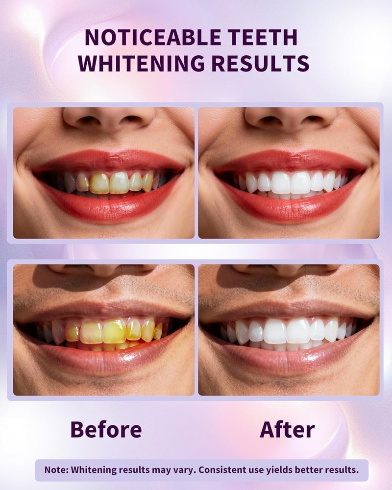 Purple Whitening Strips, Gently Remove Tooth Stains, Protect Tooth Enamel, Use Advanced 9d Whitening Technology to Create A Brighter Smile, Enamel Safe for Sensitive Tooth, 28 Strips - Image 2