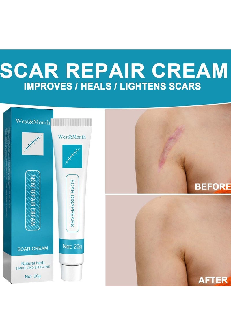 West&Month Scar Repair Cream Dilute Hyperplasia Pregnancy Surgery Burn Scald Skin Repair Scar Cream 20g - Image 1