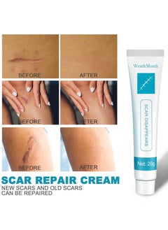 West&Month Scar Repair Cream Dilute Hyperplasia Pregnancy Surgery Burn Scald Skin Repair Scar Cream 20g  - Image 4