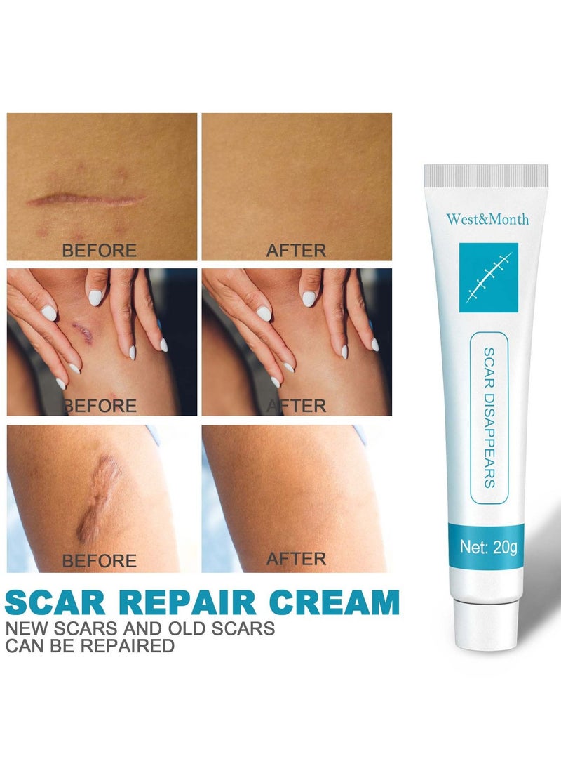 West&Month Scar Repair Cream Dilute Hyperplasia Pregnancy Surgery Burn Scald Skin Repair Scar Cream 20g - Image 4