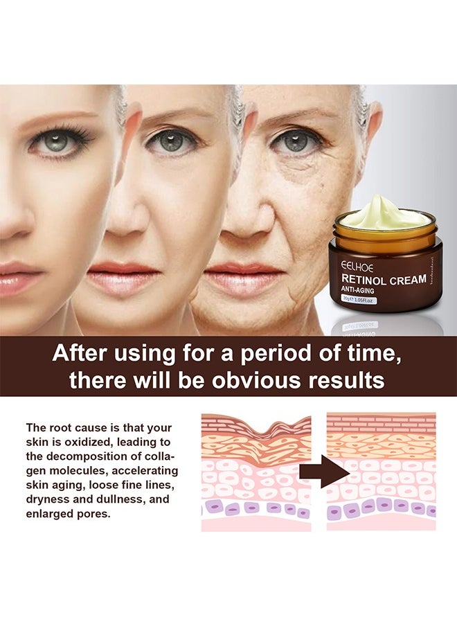 Retinol Cream, Ant-Aging Wrinkle Firming Cream, Retinol Firming and Revitalizing Cream 30g