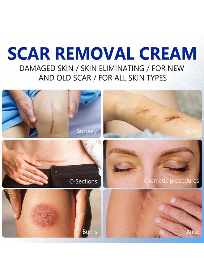 إليمي كريم إزالة الندبات، جل معالجة الندبات المتقدمة، كريم علامات الإصلاح، للندبات الجراحية، كريم تغذية وتفتيح البشرة، ندبات حب الشباب، علامات التمدد - فعال للندبات القديمة والجديدة 50 مل - Image 4