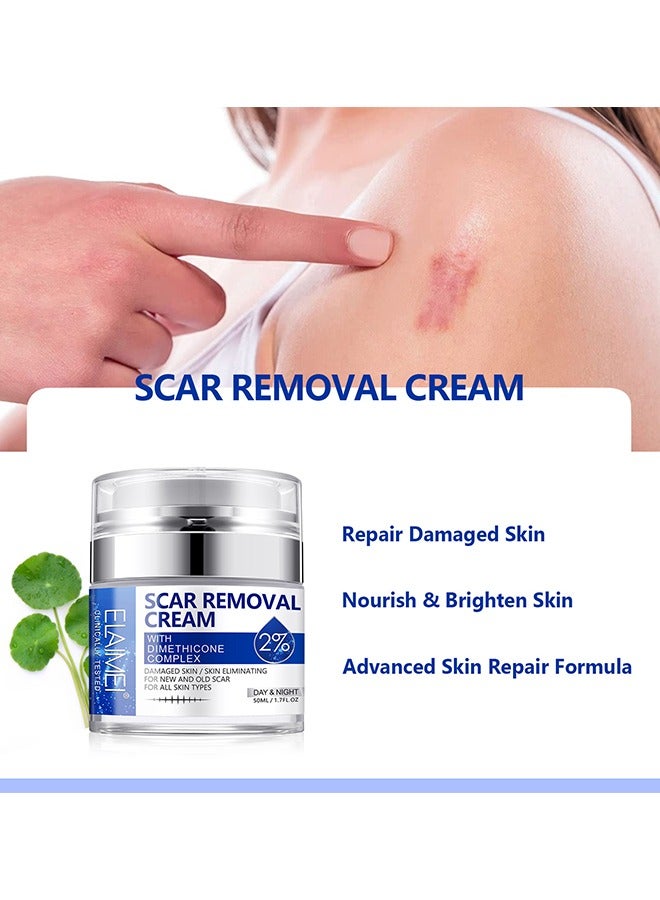إليمي كريم إزالة الندبات، جل معالجة الندبات المتقدمة، كريم علامات الإصلاح، للندبات الجراحية، كريم تغذية وتفتيح البشرة، ندبات حب الشباب، علامات التمدد - فعال للندبات القديمة والجديدة 50 مل - Image 5