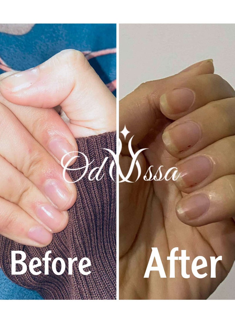 Odyssa - Odyssa Nail Serum - Image 1