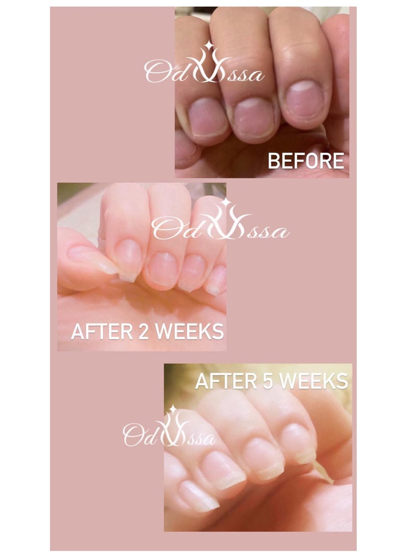 Odyssa - Odyssa Nail Serum - Image 1