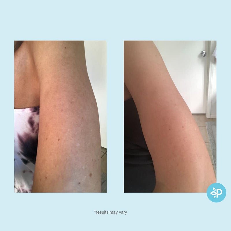 PERFECT IMAGE Hydro-Glo Peel Pads - Enhanced with Kojic, Mandelic, Glutathione, Licorice, Papaya, Pineapple, Bearberry Extracts (10% Strength Peel) - Image 3