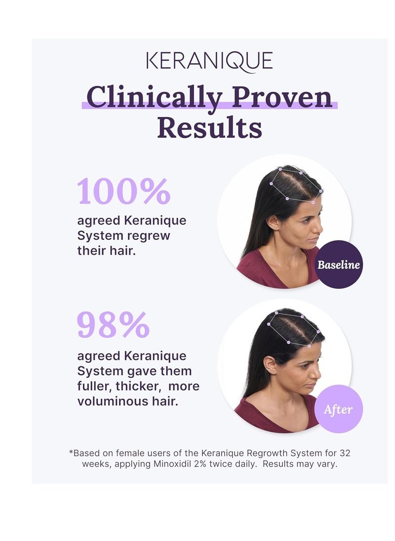 Keranique Keranique Women's 5% Topical Minoxidil Foam – Hair Regrowth Scalp Treatment with Powerful NutriGrow blend - Supports Thicker, Fuller, Healthier Hair & Scalp 2 pack  - Image 2