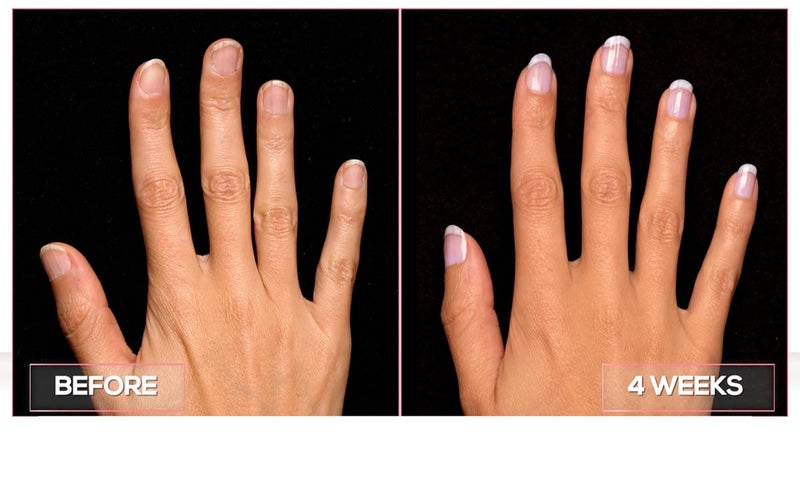 Perfect Formula Manicure Booster - Base and Top Coat Nail Strengthener, Keratin Treatment - Strengthener for Damaged Nails - Made In The USA .60 fl oz. - Image 5